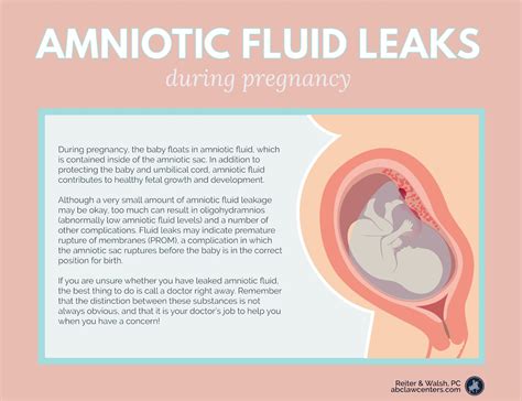 can amniotic fluid leak and then stop|Leaking amniotic fluid: Signs and what to do